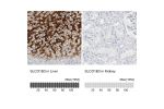 Immunohistochemistry analysis in human liver and kidney tissues using HPA004943 antibody. Corresponding SLCO1B3 RNA-seq data are presented for the same tissues.