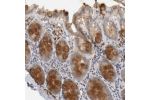 Immunohistochemical staining of human colon shows strong cytoplasmic positivity in glandular cells.