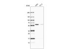 Western blot analysis in human cell line K562 and human cell line PC-3.