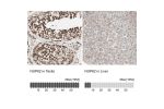 Immunohistochemistry analysis in human testis and liver tissues using HPA005435 antibody. Corresponding NUP62 RNA-seq data are presented for the same tissues.