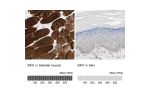 Immunohistochemistry analysis in human skeletal muscle and skin tissues using Anti-BIN1 antibody. Corresponding BIN1 RNA-seq data are presented for the same tissues.