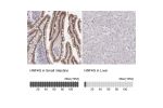 Immunohistochemistry analysis in human small intestine and liver tissues using Anti-HNF4G antibody. Corresponding HNF4G RNA-seq data are presented for the same tissues.