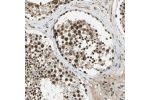 Immunohistochemical staining of human testis shows strong nuclear positivity in cells in seminiferus ducts.