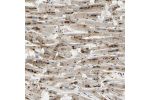 Immunohistochemical staining of human heart muscle shows strong granular cytoplasmic positivity in cardiomyocytes.