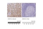 Immunohistochemistry analysis in human stomach and tonsil tissues using HPA005469 antibody. Corresponding ANXA10 RNA-seq data are presented for the same tissues.