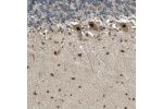 Immunohistochemical staining of human cerebellum shows strong nuclear and cytoplasmic positivity in purkinje cells.