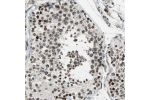 Immunohistochemical staining of human testis shows strong nuclear positivity in cells in seminiferus ducts.
