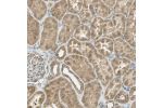 Immunohistochemical staining of human kidney shows moderate cytoplasmic positivity in cells in tubules.