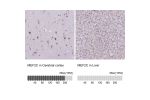 Immunohistochemistry analysis in human cerebral cortex and liver tissues using HPA005533 antibody. Corresponding MEF2C RNA-seq data are presented for the same tissues.