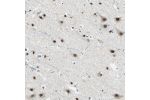 Immunohistochemical staining of human cerebral cortex shows strong nuclear positivity in neuronal cells.