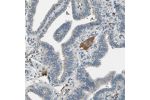 Immunohistochemical staining of human fallopian tube shows moderate positivity in plasma in blood vessels.