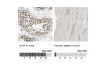 Immunohistochemistry analysis in human testis and skeletal muscle tissues using HPA005554 antibody. Corresponding ARSA RNA-seq data are presented for the same tissues.