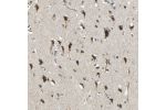 Immunohistochemical staining of human cerebral cortex shows moderate to strong cytoplasmic positivity in neurons.