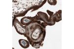 Immunohistochemical staining of human placenta shows strong cytoplasmic positivity in trophoblastic cells.