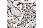 Immunohistochemical staining of human placenta shows nuclear positivity in trophoblastic cells.