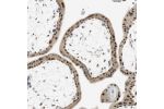 Immunohistochemical staining of human placenta shows strong nuclear positivity in trophoblastic cells.