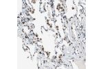 Immunohistochemical staining of human lung shows moderate to strong nuclear positivity in macrophages.