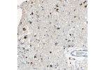 Immunohistochemical staining of human caudate shows strong cytoplasmic positivity in glial cells.