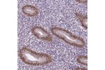 Immunohistochemical staining of human endometrium shows strong nuclear positivity in glandular cells.