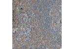 Immunohistochemical staining of human tonsil shows moderate to strong cytoplasmic positivity in lymphoid cells.