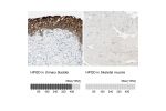 Immunohistochemistry analysis in human urinary bladder and skeletal muscle tissues using HPA005679 antibody. Corresponding HPGD RNA-seq data are presented for the same tissues.