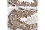 Immunohistochemical staining of human testis shows strong cytoplasmic and nuclear positivity in cells in seminiferous ducts and leydig cells.