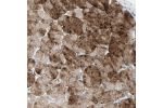 Immunohistochemical staining of human stomach shows strong nuclear and cytoplasmic positivity in glandular cells.