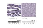 Immunohistochemistry analysis in human fallopian tube and liver tissues using HPA005714 antibody. Corresponding FOXJ1 RNA-seq data are presented for the same tissues.