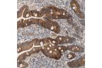 Immunohistochemical staining of human duodenum shows strong cytoplasmic positivity in glandular cells.