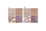Immunohistochemical staining of human cerebellum, cerebral cortex, testis and tonsil using Anti-FSCN1 antibody HPA005723 (A) shows similar protein distribution across tissues to independent antibody HPA050654 (B).