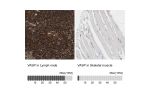 Immunohistochemistry analysis in human lymph node and skeletal muscle tissues using HPA005724 antibody. Corresponding VASP RNA-seq data are presented for the same tissues.