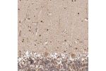 Immunohistochemical staining of human cerebellum shows moderate nuclear positivity in cells in molecular layer.