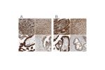 Immunohistochemical staining of human gastrointestinal, liver, placenta and prostate using Anti-GALT antibody HPA005729 (A) shows similar protein distribution across tissues to independent antibody HPA004868 (B).