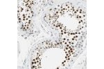 Immunohistochemical staining of human testis shows strong nuclear positivity in cells of seminiferus ducts.