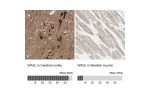 Immunohistochemistry analysis in human cerebral cortex and skeletal muscle tissues using HPA005750 antibody. Corresponding WASL RNA-seq data are presented for the same tissues.