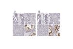 Immunohistochemical staining of human colon, kidney, liver and testis using Anti-PBK antibody HPA005753 (A) shows similar protein distribution across tissues to independent antibody HPA050656 (B).