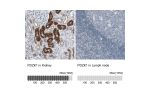 Immunohistochemistry analysis in human kidney and lymph node tissues using Anti-PDZK1 antibody. Corresponding PDZK1 RNA-seq data are presented for the same tissues.