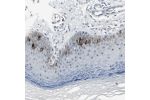 Immunohistochemical staining of human skin shows strong nuclear and cytoplasmic positivity in epidermal cells.