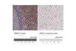 Immunohistochemistry analysis in human tonsil and cerebral cortex tissues using Anti-GRAP2 antibody. Corresponding GRAP2 RNA-seq data are presented for the same tissues.