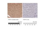 Immunohistochemistry analysis in human cerebral cortex and liver tissues using HPA005792 antibody. Corresponding PCP4 RNA-seq data are presented for the same tissues.