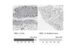 Immunohistochemistry analysis in human skin and skeletal muscle tissues using HPA005798 antibody. Corresponding GRHL1 RNA-seq data are presented for the same tissues.