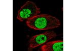 Immunofluorescent staining of human cell line PC-3 shows localization to nucleoplasm.