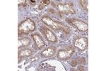 Immunohistochemical staining of human kidney shows moderate cytoplasmic and membranous positivity in cells in tubules.