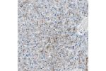 Immunohistochemical staining of human hippocampus shows moderate granular positivity in neuronal and glial cells.