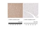 Immunohistochemistry analysis in human cerebral cortex and skeletal muscle tissues using HPA005830 antibody. Corresponding L1CAM RNA-seq data are presented for the same tissues.