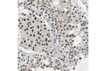 Immunohistochemical staining of human testis shows strong nuclear positivity in cells of seminiferus ducts and leydig cells.