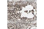 Immunohistochemical staining of human testis shows strong cytoplasmic positivity in cells in seminiferous ducts.