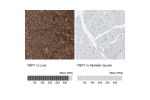 Immunohistochemistry analysis in human liver and skeletal muscle tissues using HPA005857 antibody. Corresponding FBP1 RNA-seq data are presented for the same tissues.