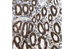 Immunohistochemical staining of human stomach shows strong cytoplasmic positivity in glandular cells.