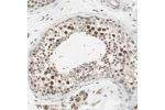 Immunohistochemical staining of human testis shows strong nuclear positivity in cells in seminiferous ducts.